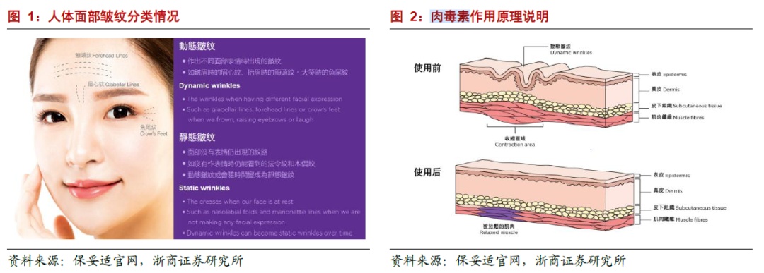 人保服务 ,人保财险政银保 _2024年中国A型肉毒毒素行业的发展现状及发展前景分析