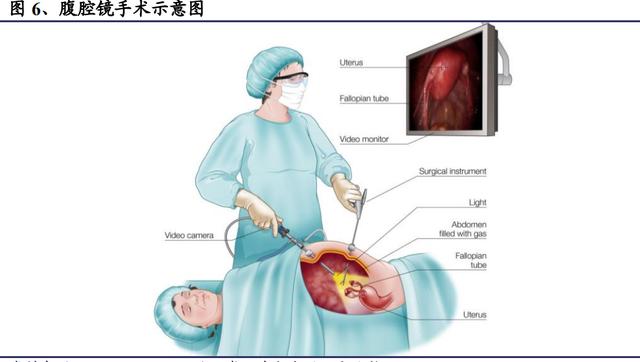 人保财险 ,拥有“如意行”驾乘险，出行更顺畅！_中国手术内窥镜行业现状及上下游产业链分析