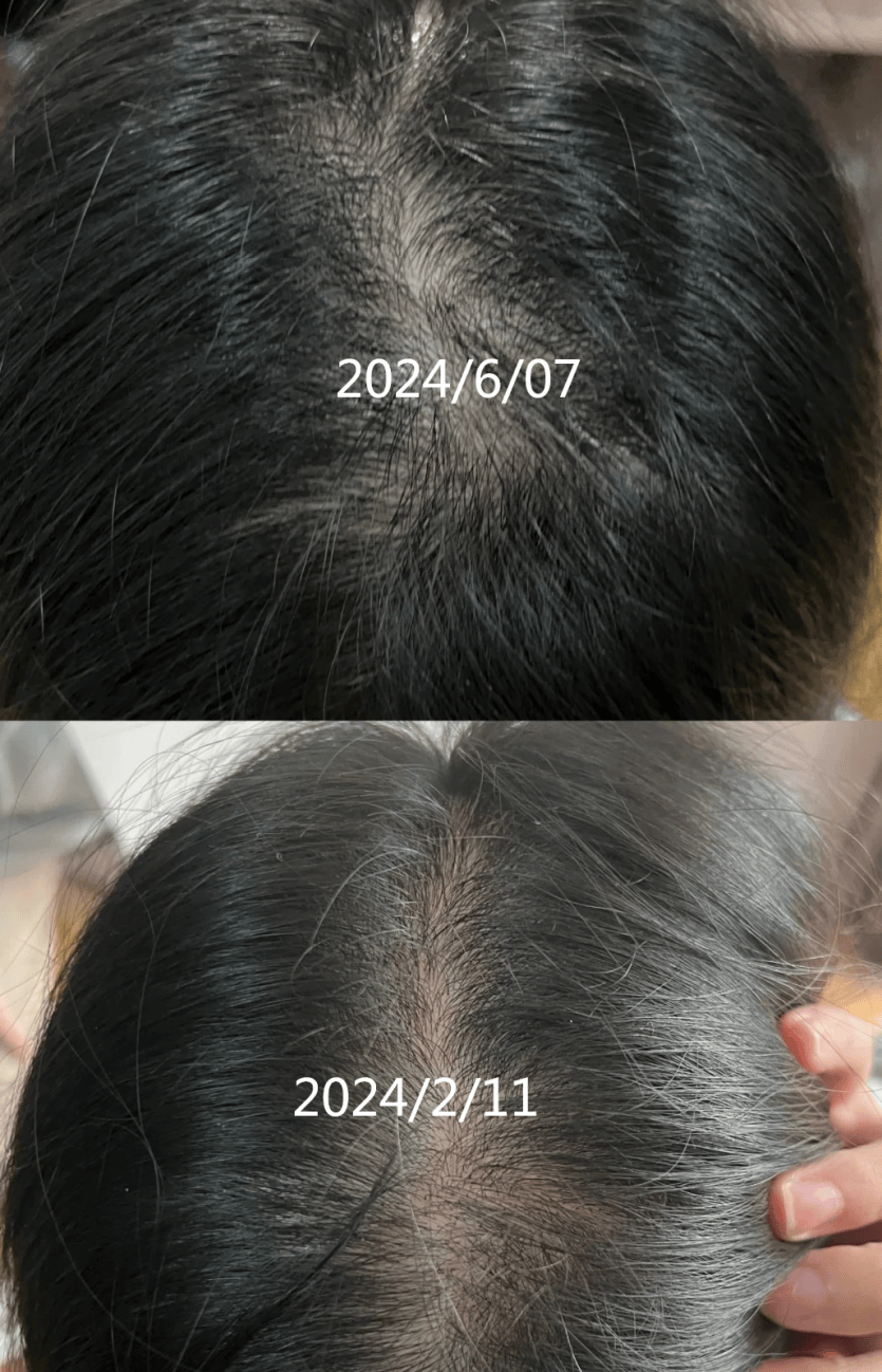 2024生发育发行业发展现状及市场规模、品牌竞争格局分析_保险有温度,人保服务