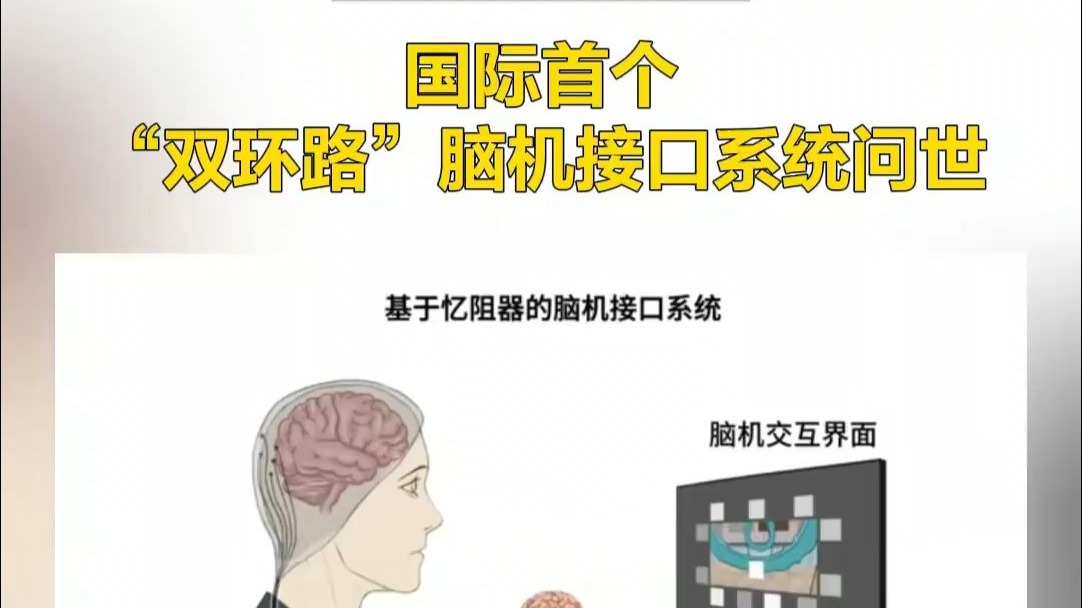 探索中国脑机接口领域：女性科创者的“柔软革命”