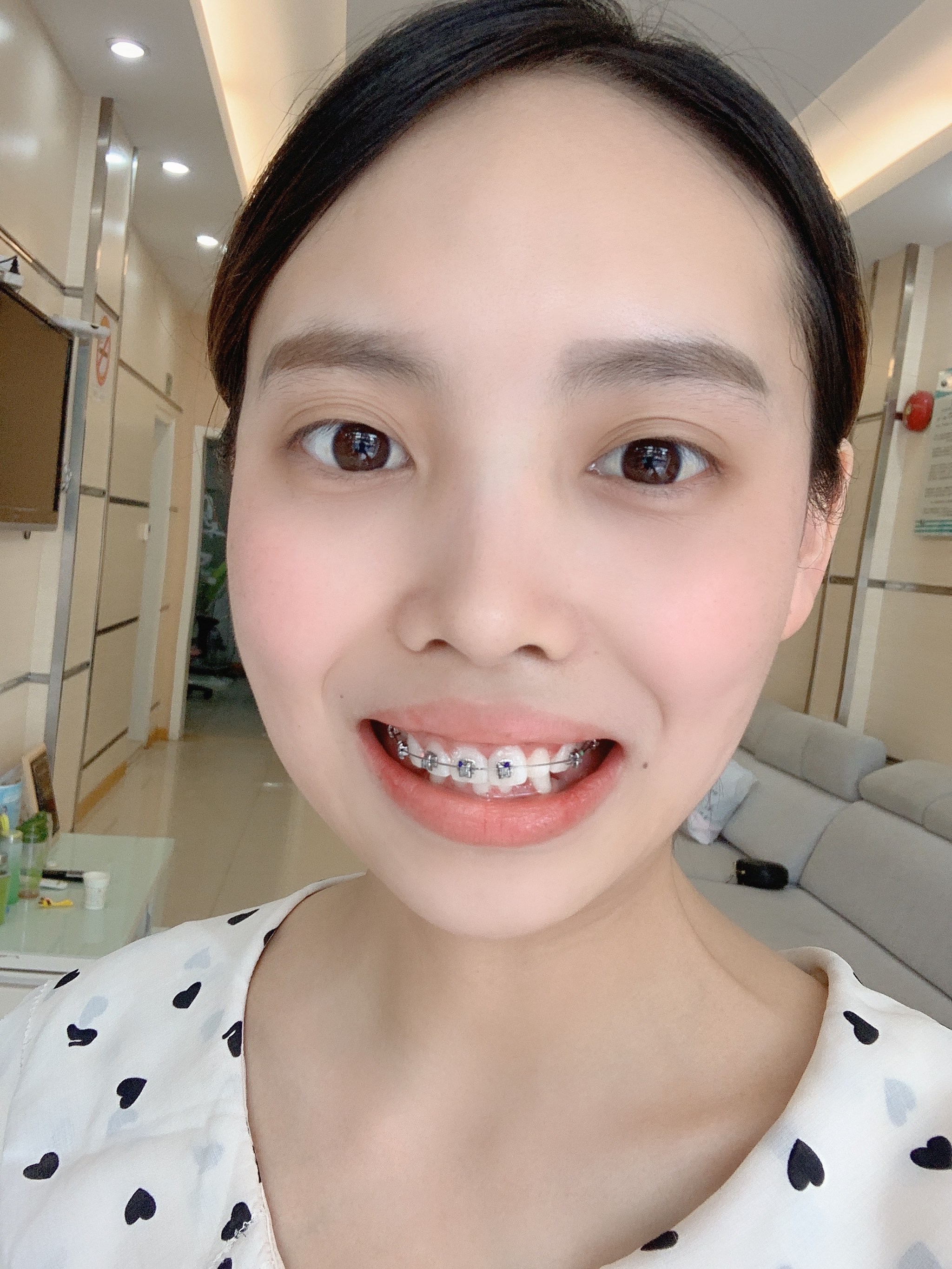 隐形牙套行业调研分析 “大众刚需”正畸市场的下沉扩张如何解决“医生资源与患者信任”的匹配难题?_人保车险 品牌优势——快速了解燃油汽车车险,人保财险