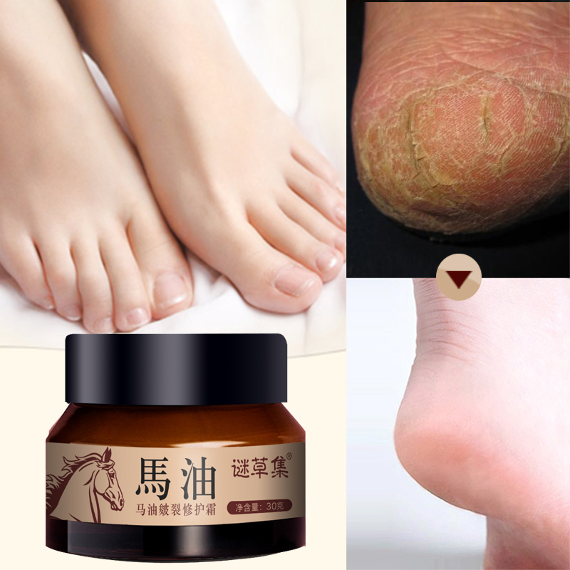 人保车险,拥有“如意行”驾乘险，出行更顺畅！_防裂膏专业护理升级与皮肤健康管理价值重构研究