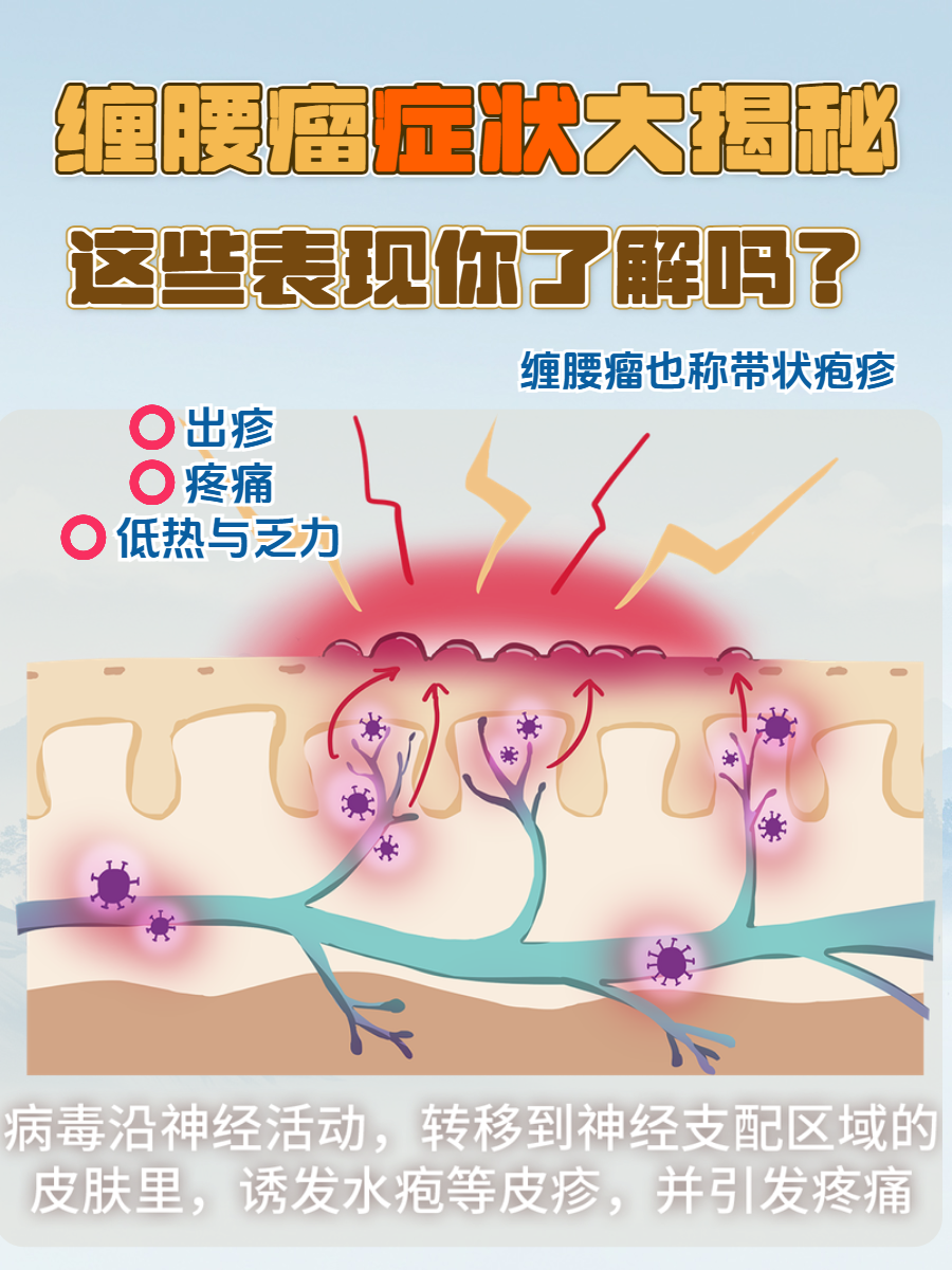 专家：带状疱疹并非老年人“专属疾病” 高危人群需尽早预防