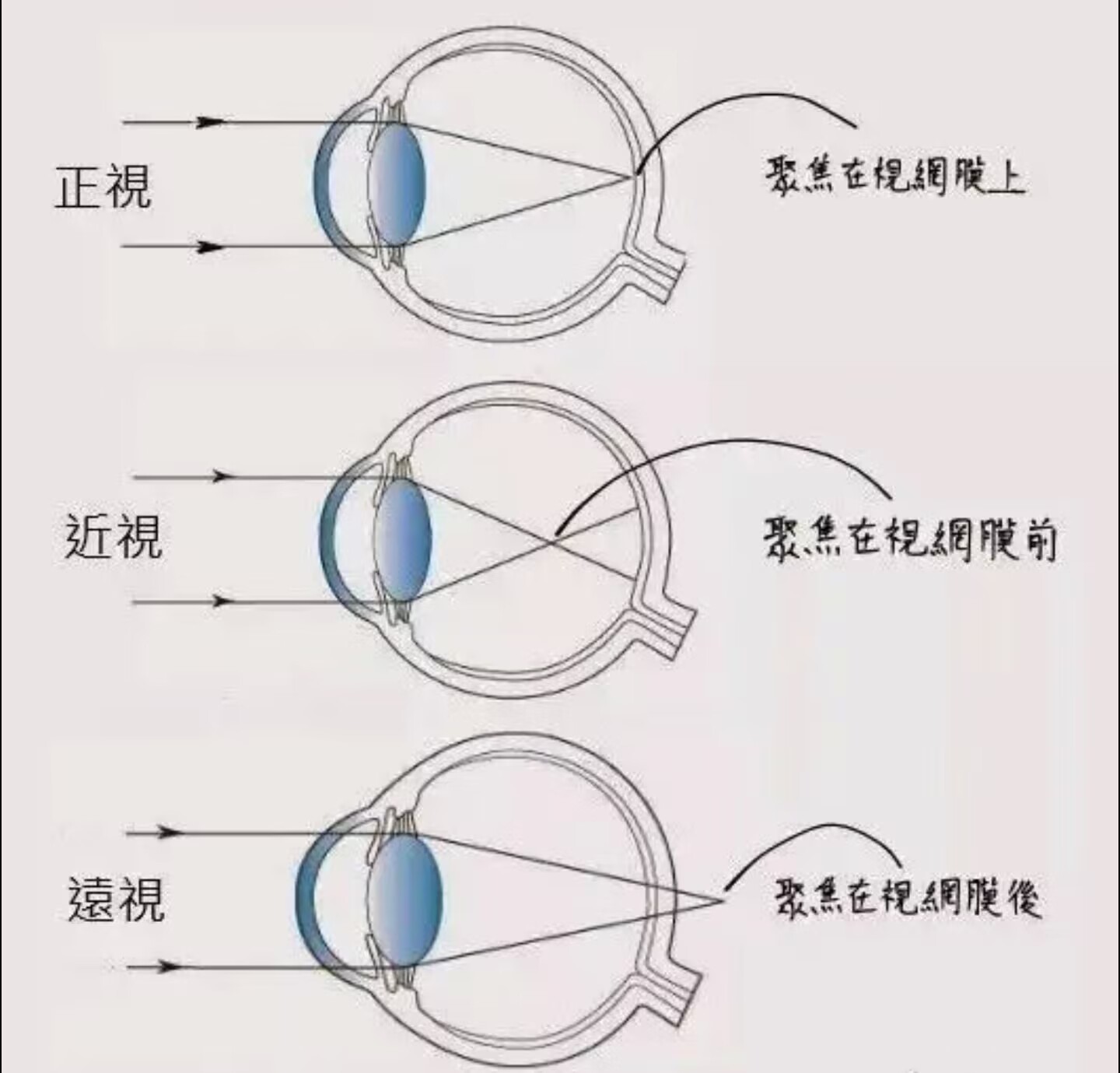 云大在《Nature》发文:已知最早脊椎动物有四只成像眼睛